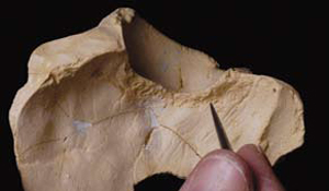 Tuberculosis: Anthropologist Discovers Oldest Case